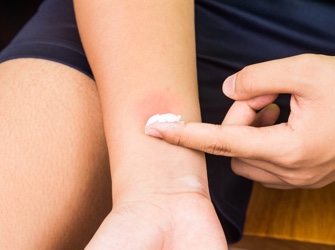 dealing with a rash or bite