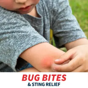 Find Bug Bite and Sting Relief at Midwest Express Clinic
