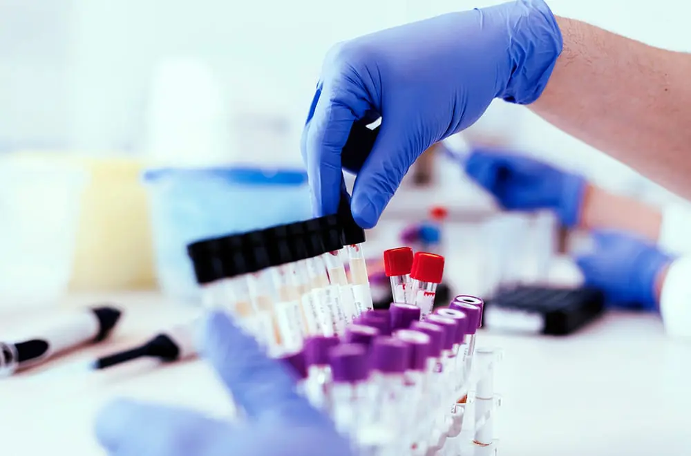 Drug-Testing_image-1