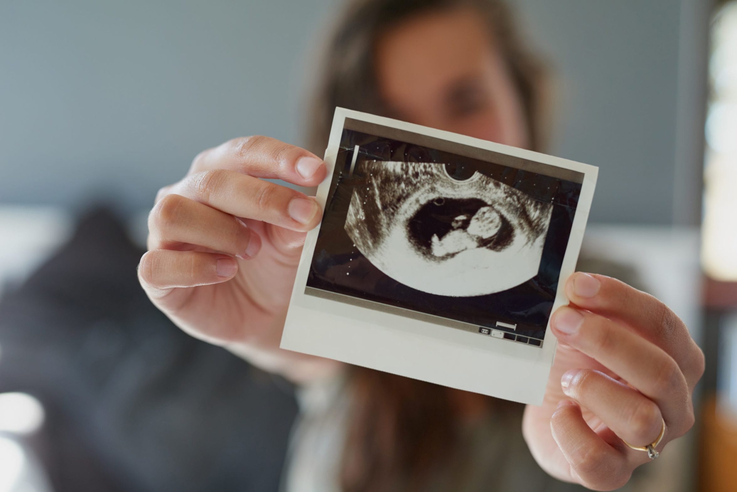 Look at my little peanut Shot of a woman holding a sonogram of her unborn baby