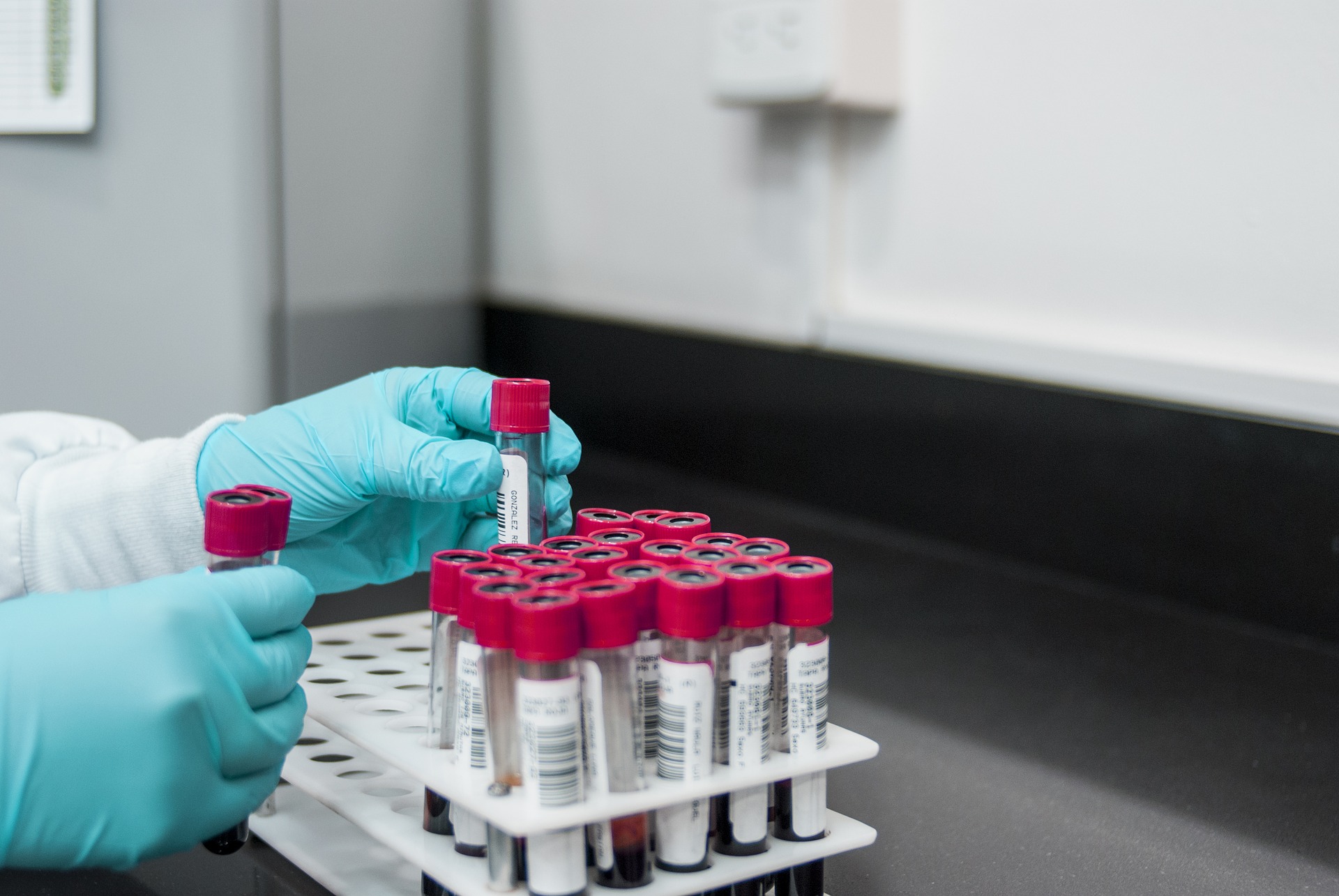 Importance of Lab Testing for Accurate Results