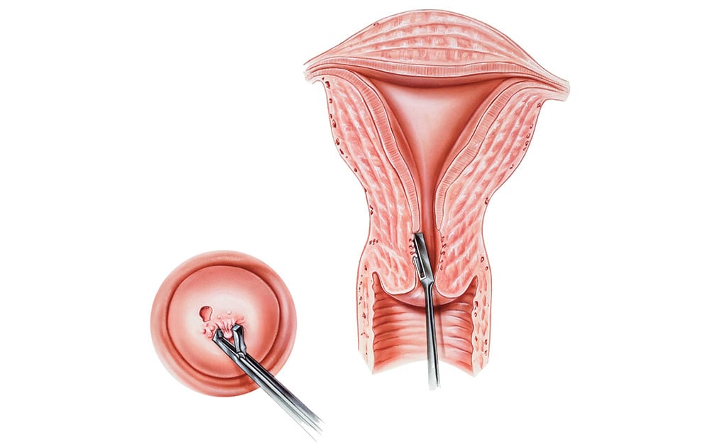 Pap-Smear-Womens-health-screening Pap-Smear-Womens-health-screening