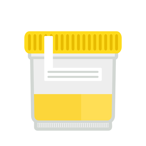Urine-Test-500 urine test illustration
