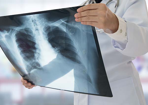 Labs, Testing & X-Rays