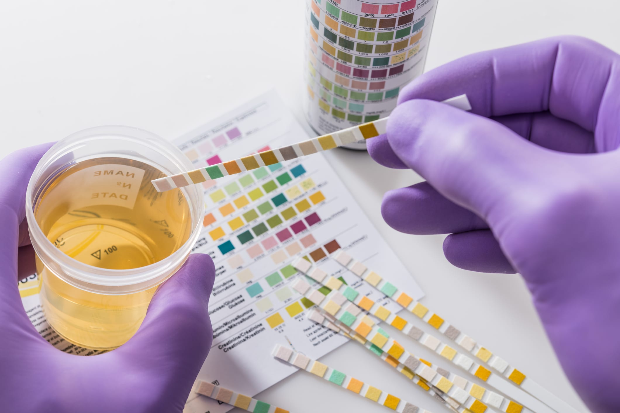 Drug Testing Services | Midwest Express Clinic