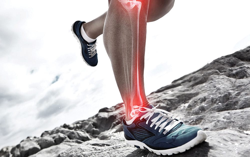 sprain-strain-tests-treatment sprain-strain-tests-treatment