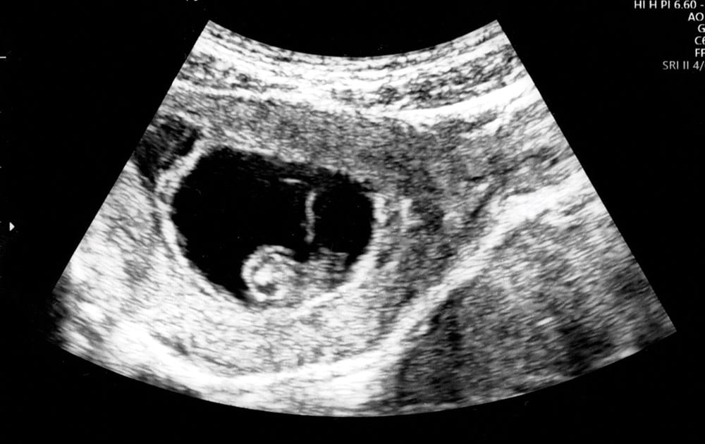 ultrasound-pregnancy-testing-gender-reveal ultrasound-pregnancy-testing-gender-reveal