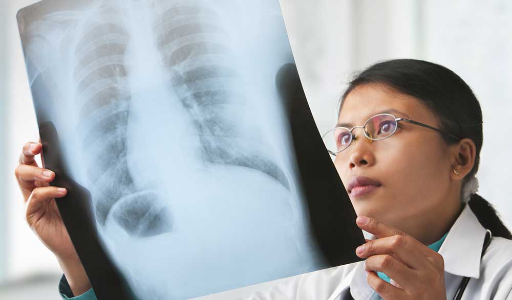 x ray